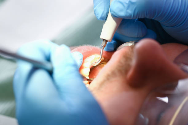 Best Tooth Pain Emergency Relief  in New Lno, LA
